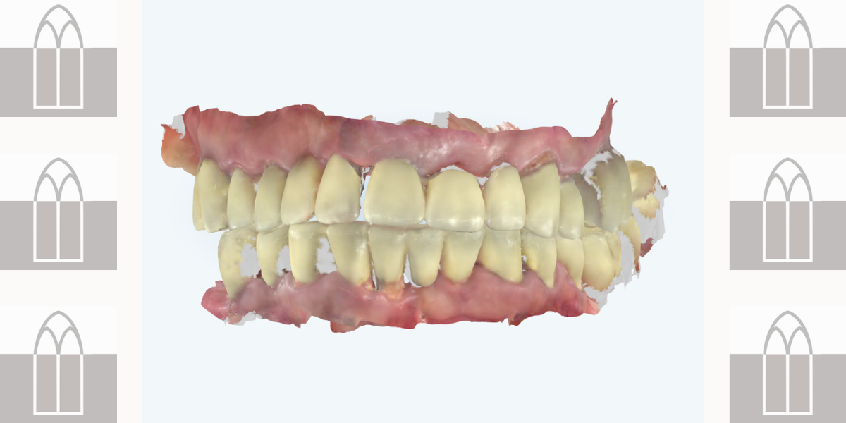 Planificación de rehabilitación oral